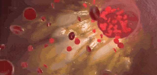 1-211222114630H1.gif